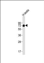 MFSD6L Antibody in Western Blot (WB)