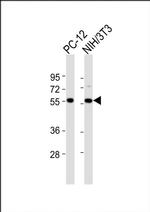 DGCR14 Antibody in Western Blot (WB)