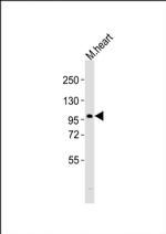 ATG9A Antibody in Western Blot (WB)