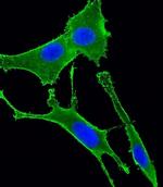 GNA11 Antibody in Immunocytochemistry (ICC/IF)