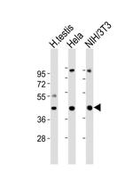 GNA11 Antibody in Western Blot (WB)