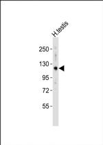 HERC4 Antibody in Western Blot (WB)
