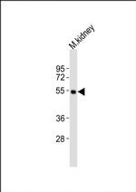 DRD5 Antibody in Western Blot (WB)