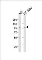 ADAMTS6 Antibody in Western Blot (WB)