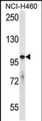 USP6 Antibody in Western Blot (WB)