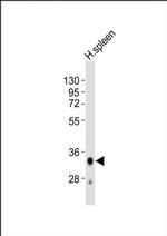HLA-DQA1 Antibody in Western Blot (WB)