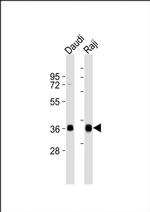 HLA-DQA1 Antibody in Western Blot (WB)