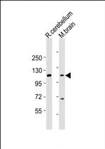 UNC5B Antibody in Western Blot (WB)