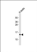 PCP2 Antibody in Western Blot (WB)