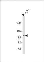 AQPEP Antibody in Western Blot (WB)