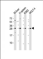 SLA2 Antibody in Western Blot (WB)