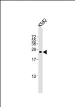 SLA2 Antibody in Western Blot (WB)
