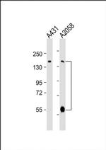 ADAMTS17 Antibody in Western Blot (WB)