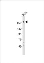 CASC5 Antibody in Western Blot (WB)