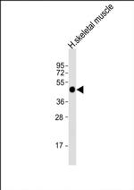 HYKK Antibody in Western Blot (WB)