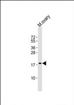 NDUFB7 Antibody in Western Blot (WB)