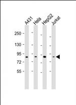NEK10 Antibody in Western Blot (WB)
