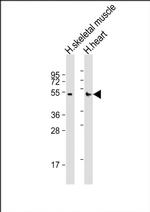 RHBDL1 Antibody in Western Blot (WB)
