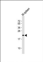 SEC11C Antibody in Western Blot (WB)