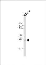 PRSS33 Antibody in Western Blot (WB)