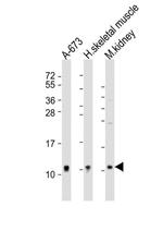 NDUFA1 Antibody in Western Blot (WB)