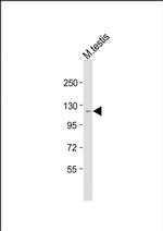 BNC2 Antibody in Western Blot (WB)