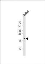 NTS Antibody in Western Blot (WB)