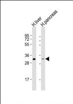 HSD17B8 Antibody in Western Blot (WB)