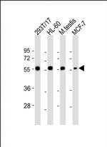 GMCL1 Antibody in Western Blot (WB)