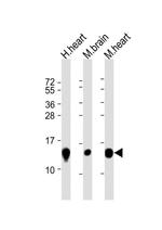 NDUFB3 Antibody in Western Blot (WB)