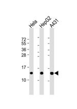 NDUFB3 Antibody in Western Blot (WB)