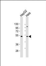 ZFP2 Antibody in Western Blot (WB)