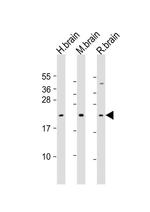 FGF12 Antibody in Western Blot (WB)