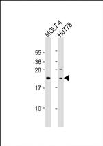 DLEU7 Antibody in Western Blot (WB)