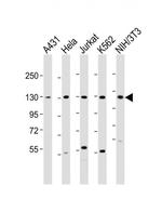 DDX42 Antibody in Western Blot (WB)