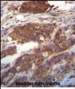 UFC1 Antibody in Immunohistochemistry (Paraffin) (IHC (P))