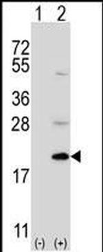 UFC1 Antibody in Western Blot (WB)
