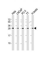 SSX1 Antibody in Western Blot (WB)