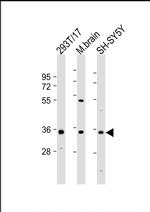 NAT8L Antibody in Western Blot (WB)