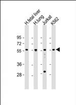 EFS Antibody in Western Blot (WB)