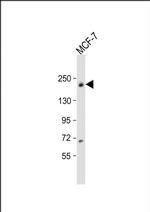 USP32 Antibody in Western Blot (WB)