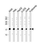 COMMD1 Antibody in Western Blot (WB)