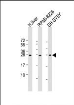 NT5M Antibody in Western Blot (WB)