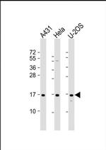 RPLP1 Antibody in Western Blot (WB)