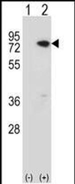 MECP2 Antibody in Western Blot (WB)