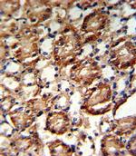 GMPS Antibody in Immunohistochemistry (Paraffin) (IHC (P))