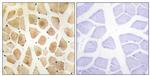 SLK Antibody in Immunohistochemistry (Paraffin) (IHC (P))