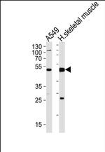 NT5C1A Antibody in Western Blot (WB)
