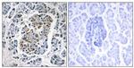 SSBP1 Antibody in Immunohistochemistry (Paraffin) (IHC (P))