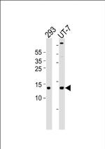 SSBP1 Antibody in Western Blot (WB)